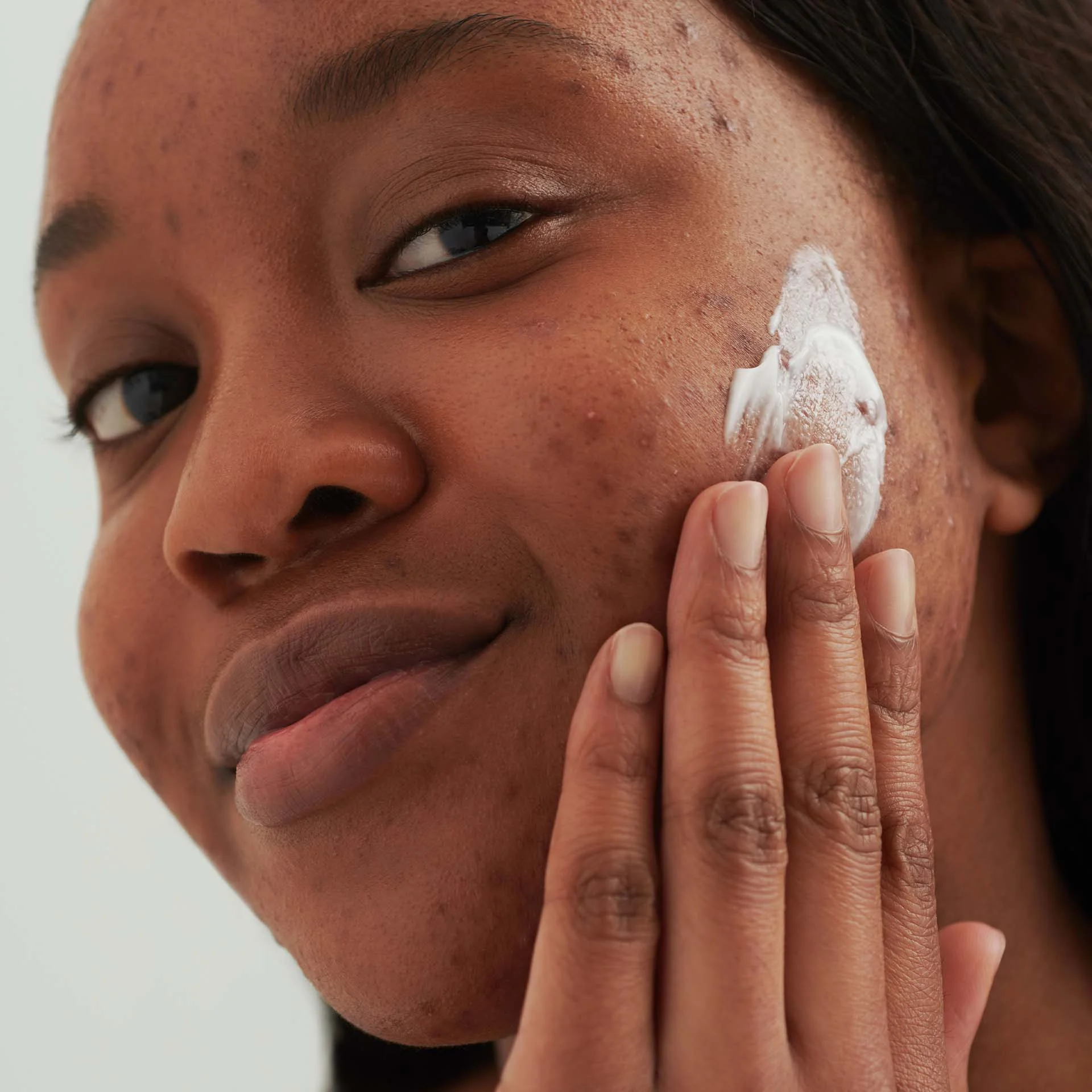 Nahaufnahme einer Person, die DADO SENS PURDERM Effektcreme auf gereizte Haut im Gesicht aufträgt