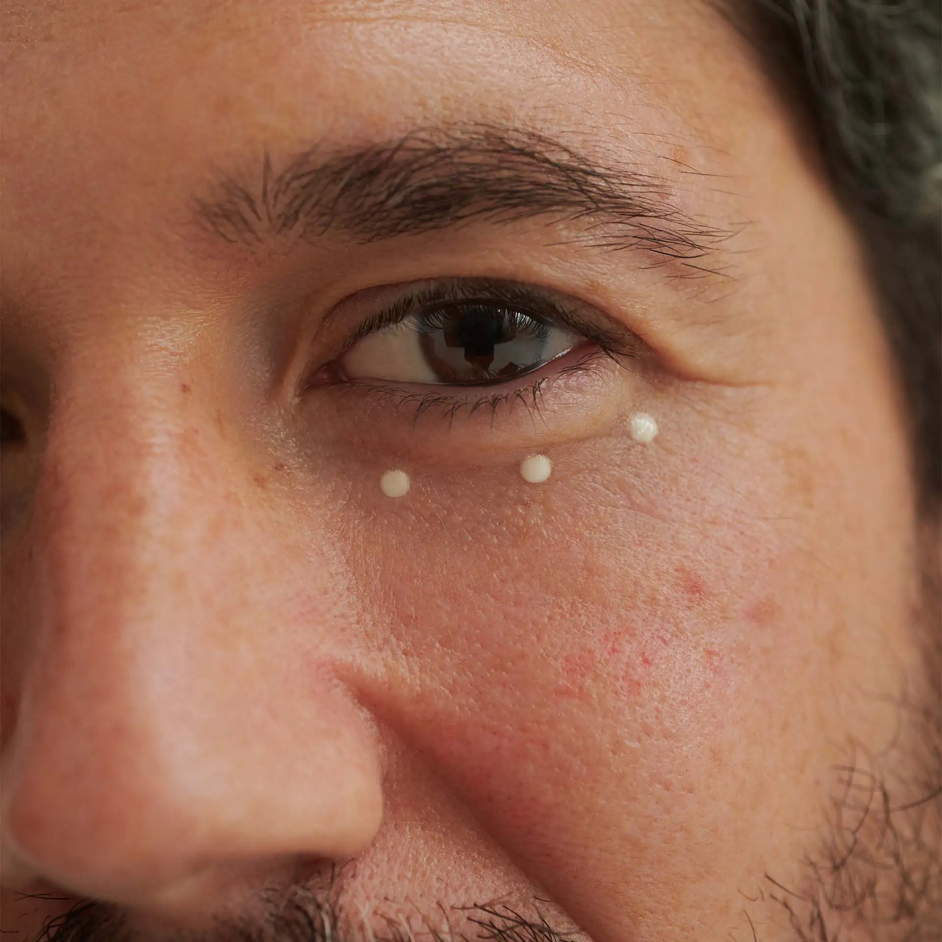 Nahaufnahme eines Auges mit drei Punkten DADO SENS ProBalance Augenfluid unter dem Auge zur Anwendung