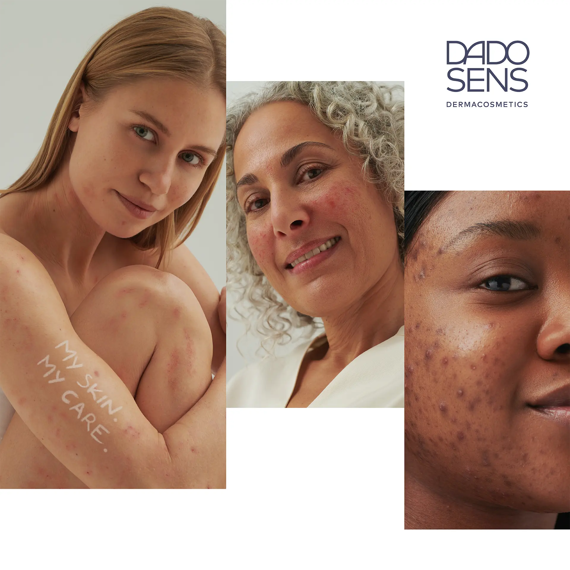 Geschenkgutschein DADO SENS Drei Frauen mit unterschiedlichen Hauttypen und Hautunreinheiten, DADO SENS Logo rechts oben