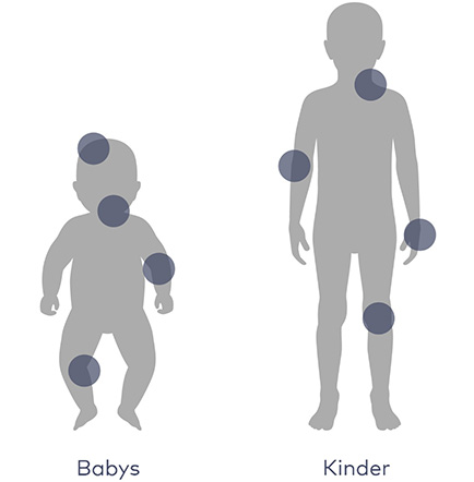 Grafik mit zwei grauen Silhouetten von Baby und Kind, markierte typische Neurodermitis-Stellen am Körper