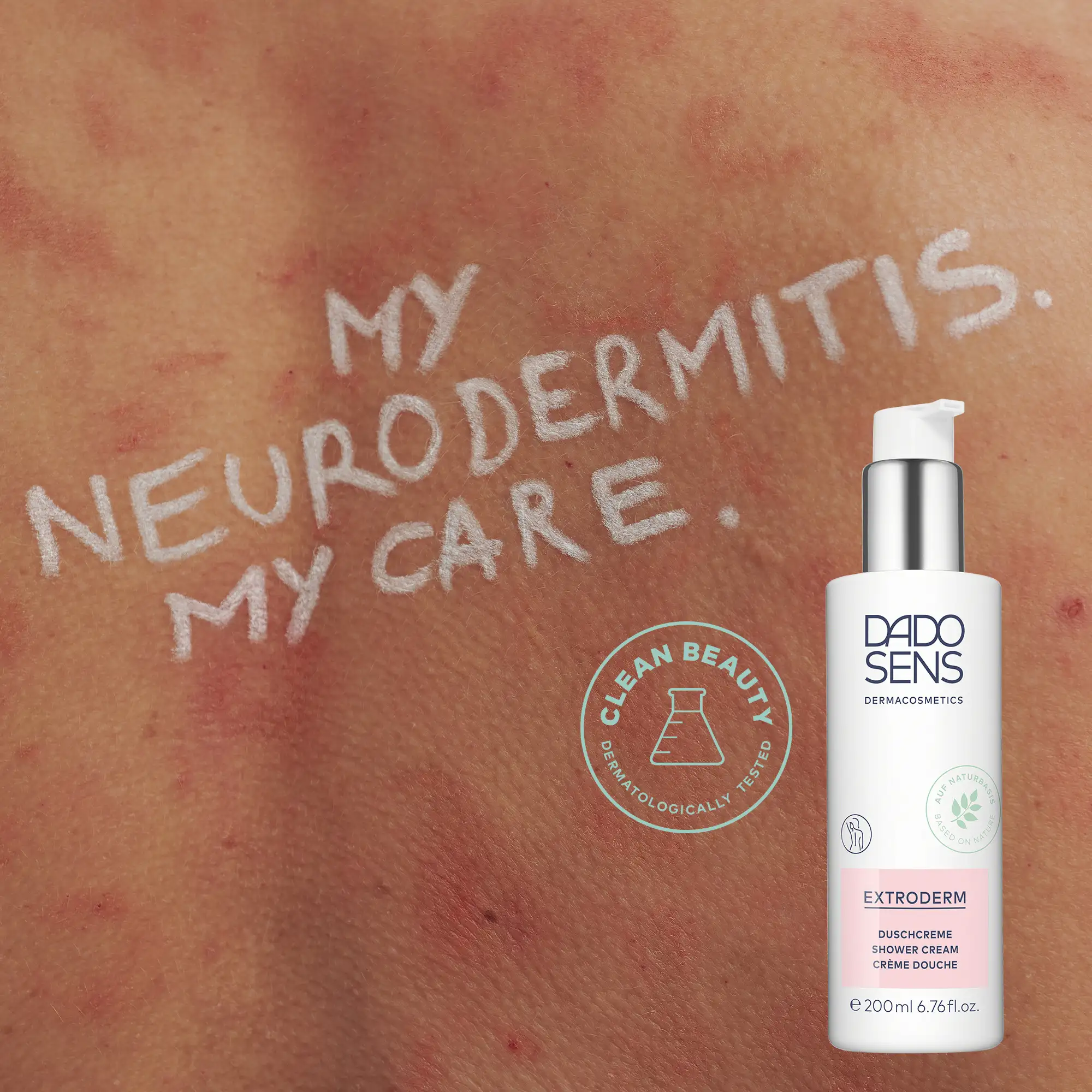 DADO SENS EXTRODERM Duschcreme vor geröteter Haut mit Neurodermitis, dermatologisch getestet, 200 ml