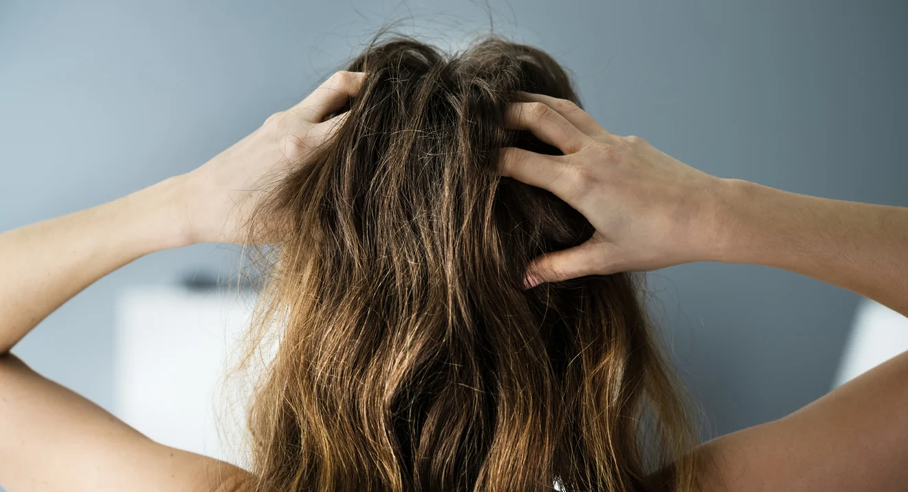 Frau kratzt sich am Kopf – Symbolbild für juckende Kopfhaut und gereizte Haut