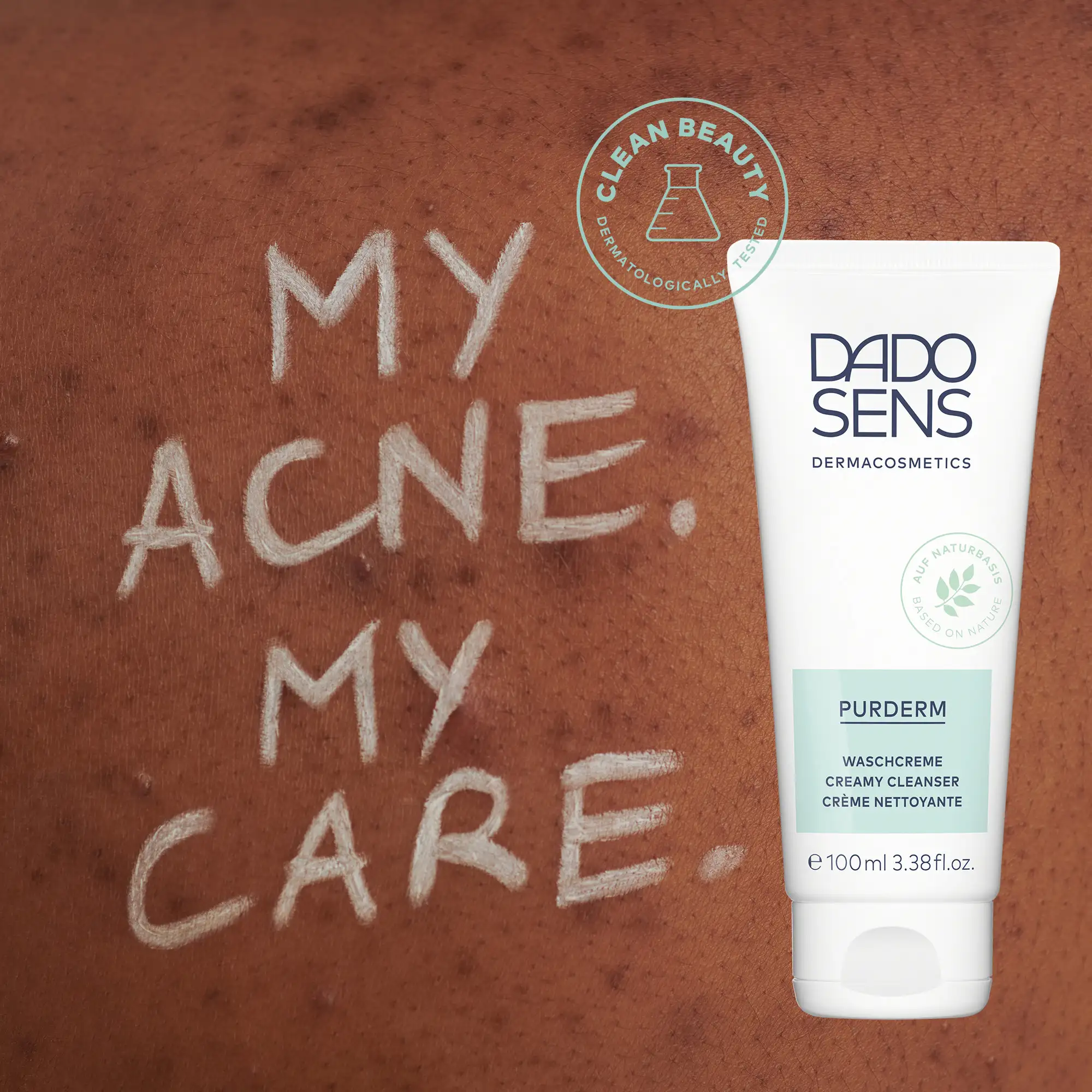 DUNKLE HAUT MIT AKNE, DARAUF WEIßER TEXT "MY ACNE. MY CARE." UND DADO SENS PURDERM Waschcreme 100 ml