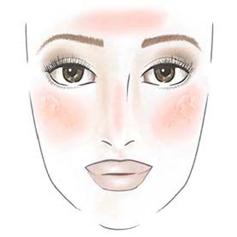 Tipps gegen Sonnenbrand Illustration eines Gesichts mit starker Rötung auf Stirn, Nase und Wangen als Zeichen für sehr starken Sonnenbrand.