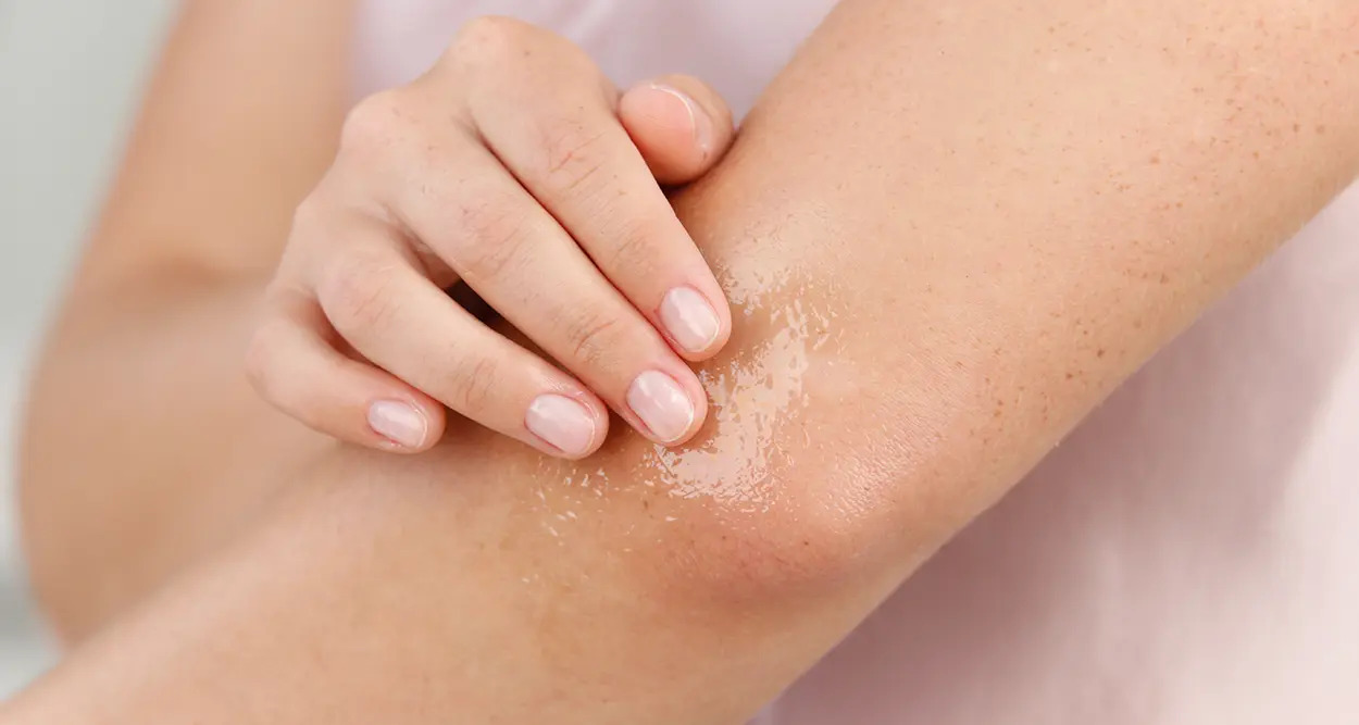 Hand cremt Ellenbogen mit feuchtigkeitsspendender Lotion ein, Nahaufnahme trockener Hautstellen