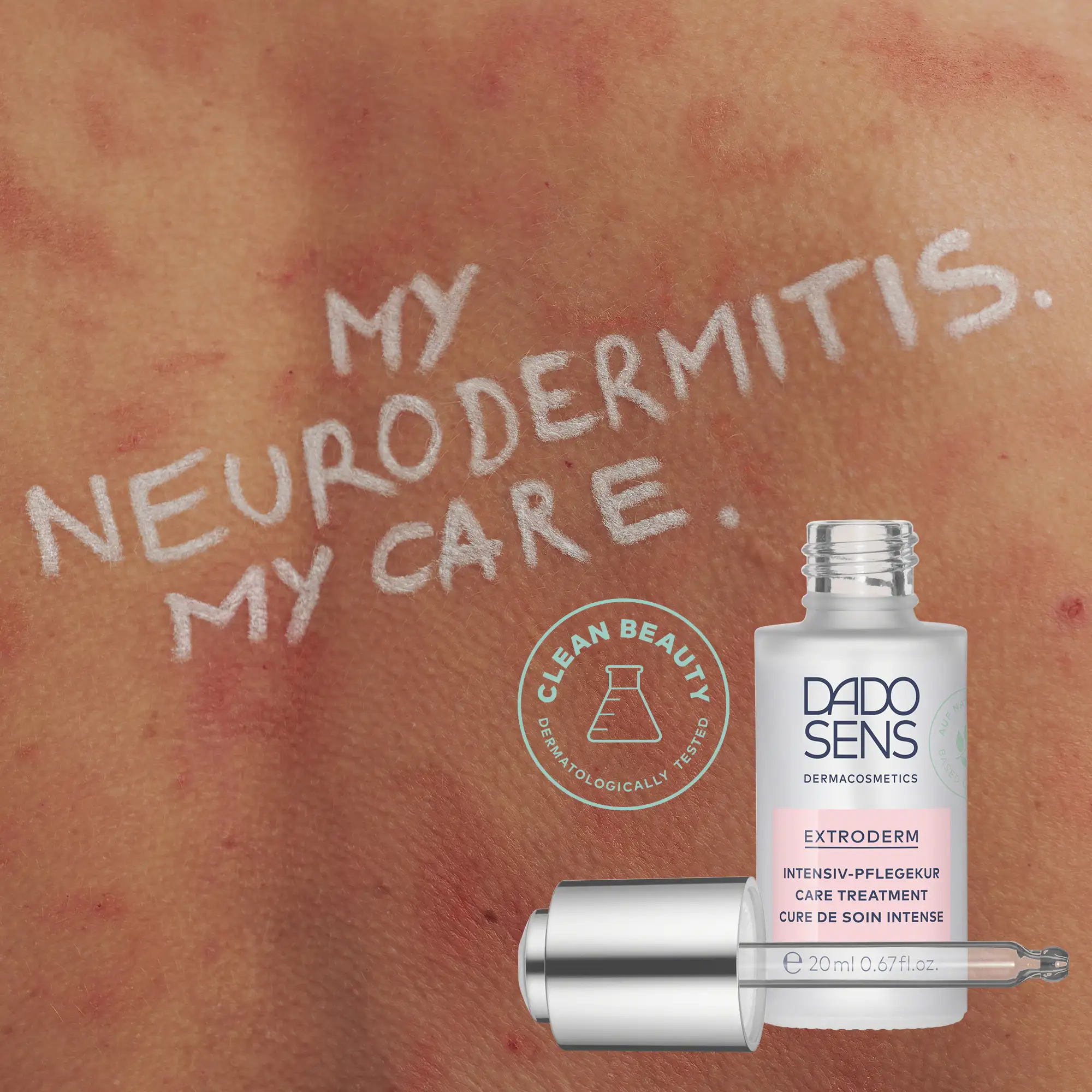 DADO SENS EXTRODERM Intensiv-Pflegekur vor geröteter Haut mit Aufschrift "My Neurodermitis. My Care.