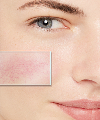SENSACEA SENSACEA