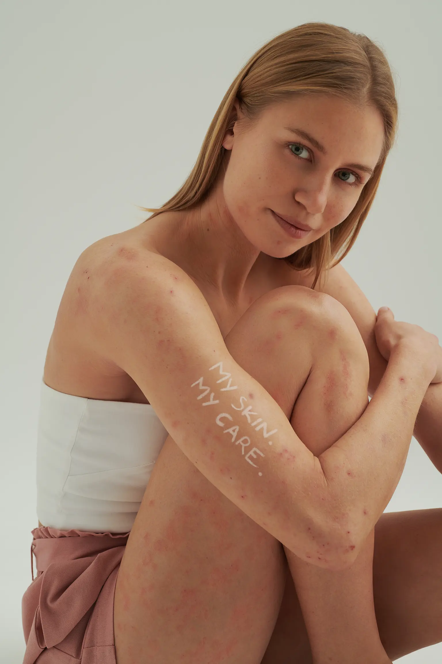 Frau sitzt mit angezogenen Beinen, zeigt gerötete Hautstellen und Schriftzug "MY SKIN. MY CARE." auf dem Arm