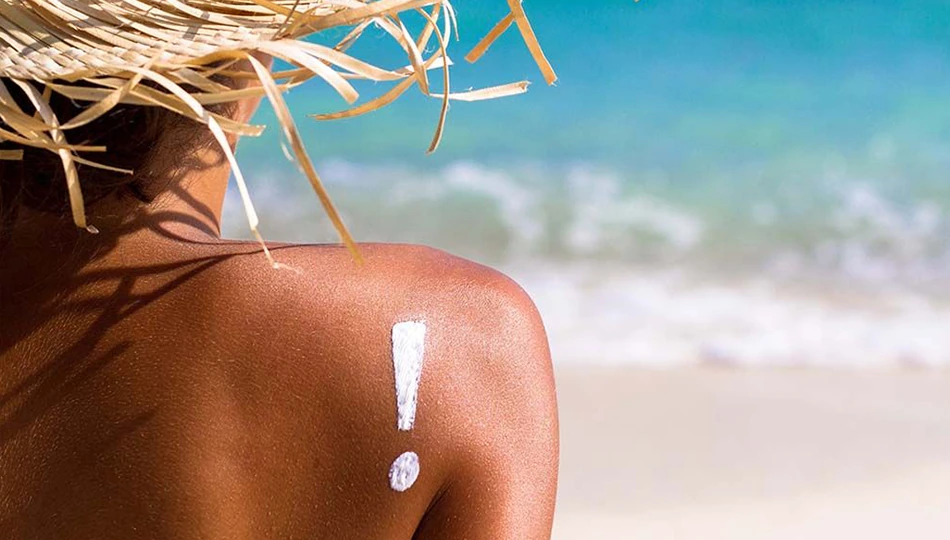 Tipps gegen Sonnenbrand