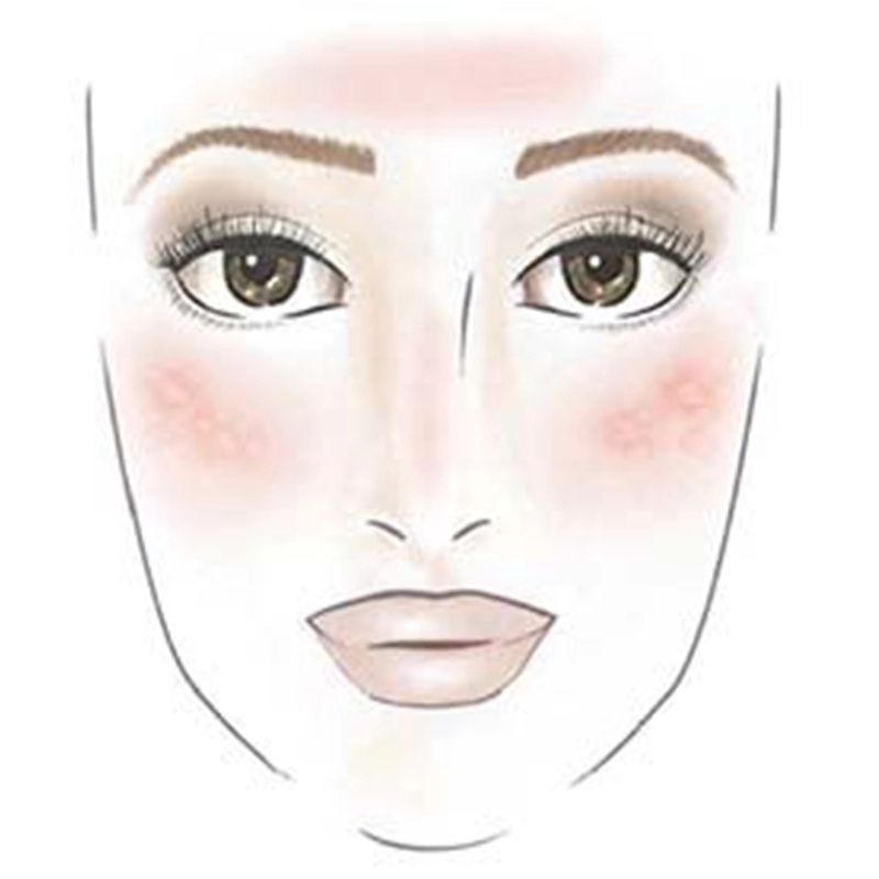 Tipps gegen Sonnenbrand Illustration eines Gesichts mit deutlicher Rötung auf Stirn und Wangen als Zeichen für starken Sonnenbrand.