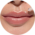 Nahaufnahme von Lippen, die mit einem transparenten Gel aus einer Pipette behandelt werden
