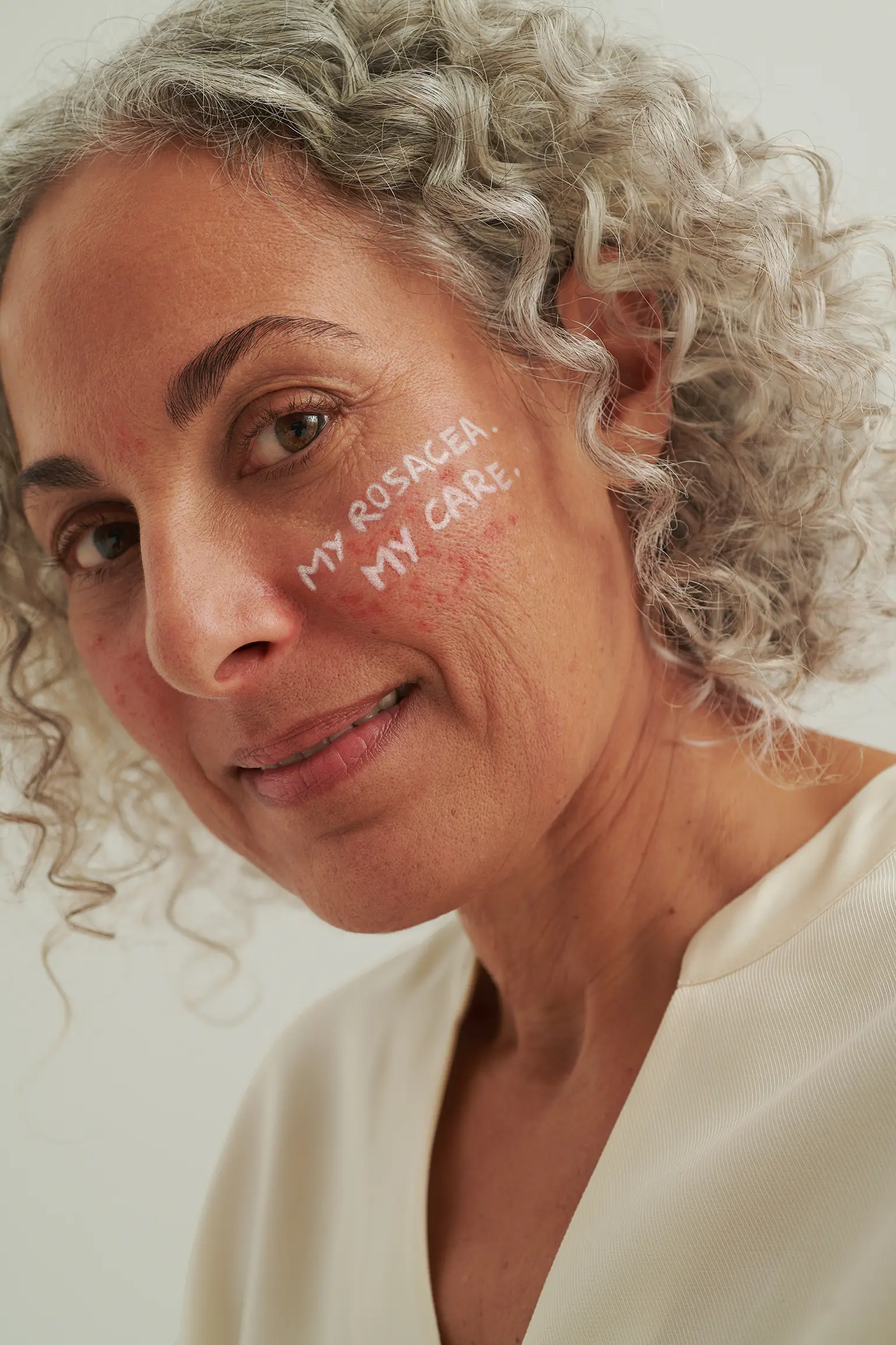 Nahaufnahme einer Frau mit grauen Locken, geröteter Haut und Schriftzug „MY ROSACEA. MY CARE.“ auf der Wange