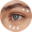 Nahaufnahme eines Auges mit aufgetragener, weißer Augen-Gel-Creme unter dem Auge und auf der Haut