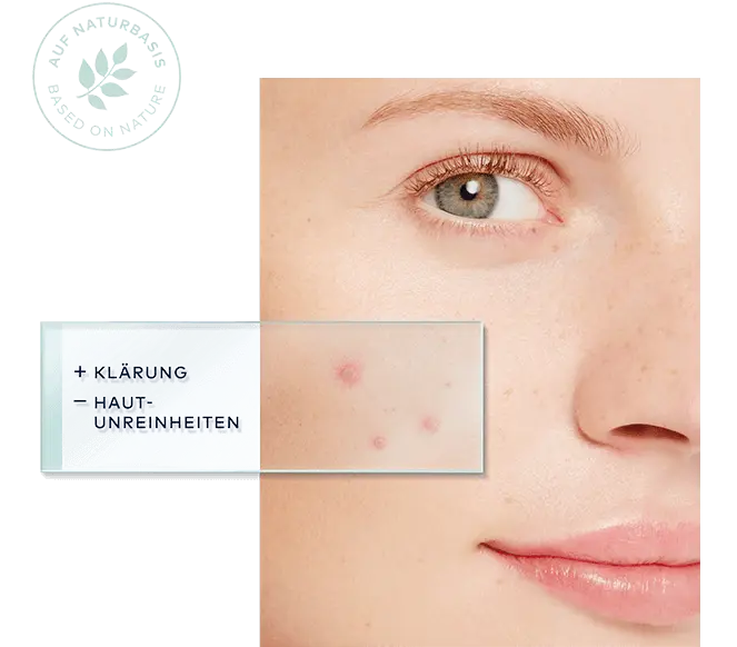 Gesicht mit Hautunreinheiten, Lupe zeigt Bereich mit Pickeln und Text "+ Klärung - Hautunreinheiten