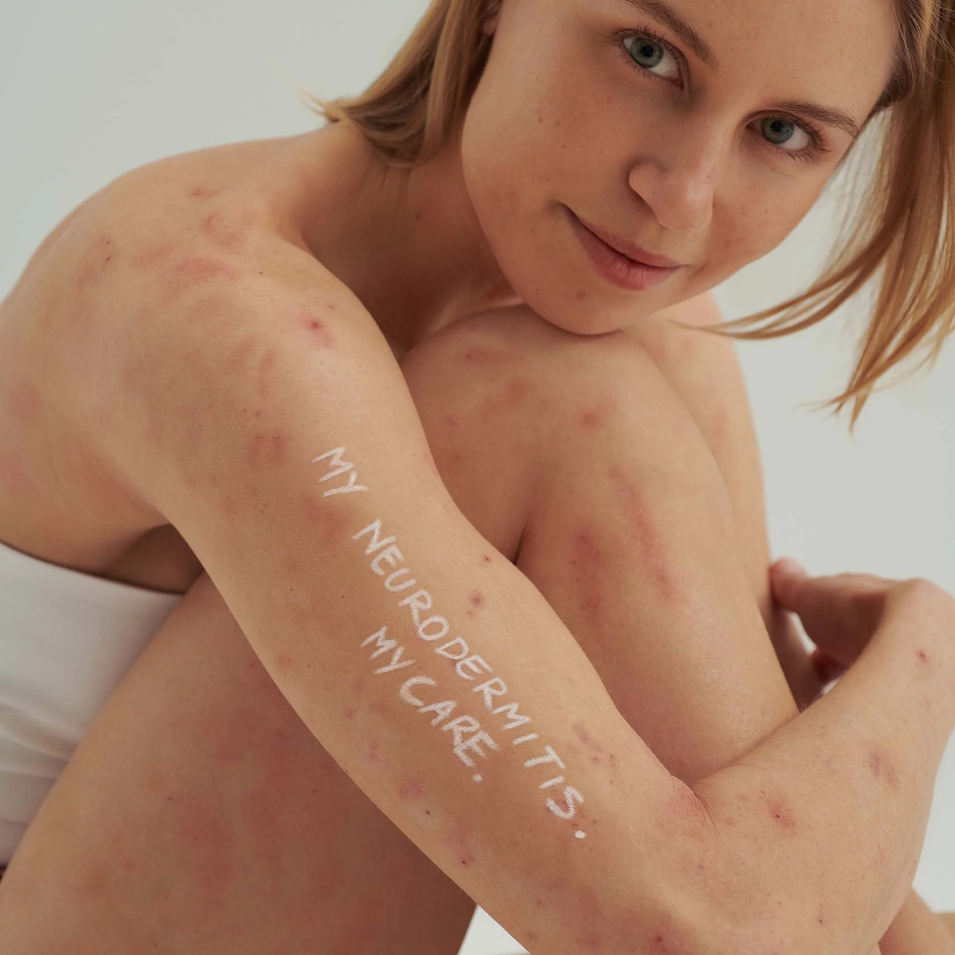 Frau mit Neurodermitis-Symptomen sitzt mit angewinkelten Beinen, Schriftzug „My Neurodermitis. My Care.“ auf Arm