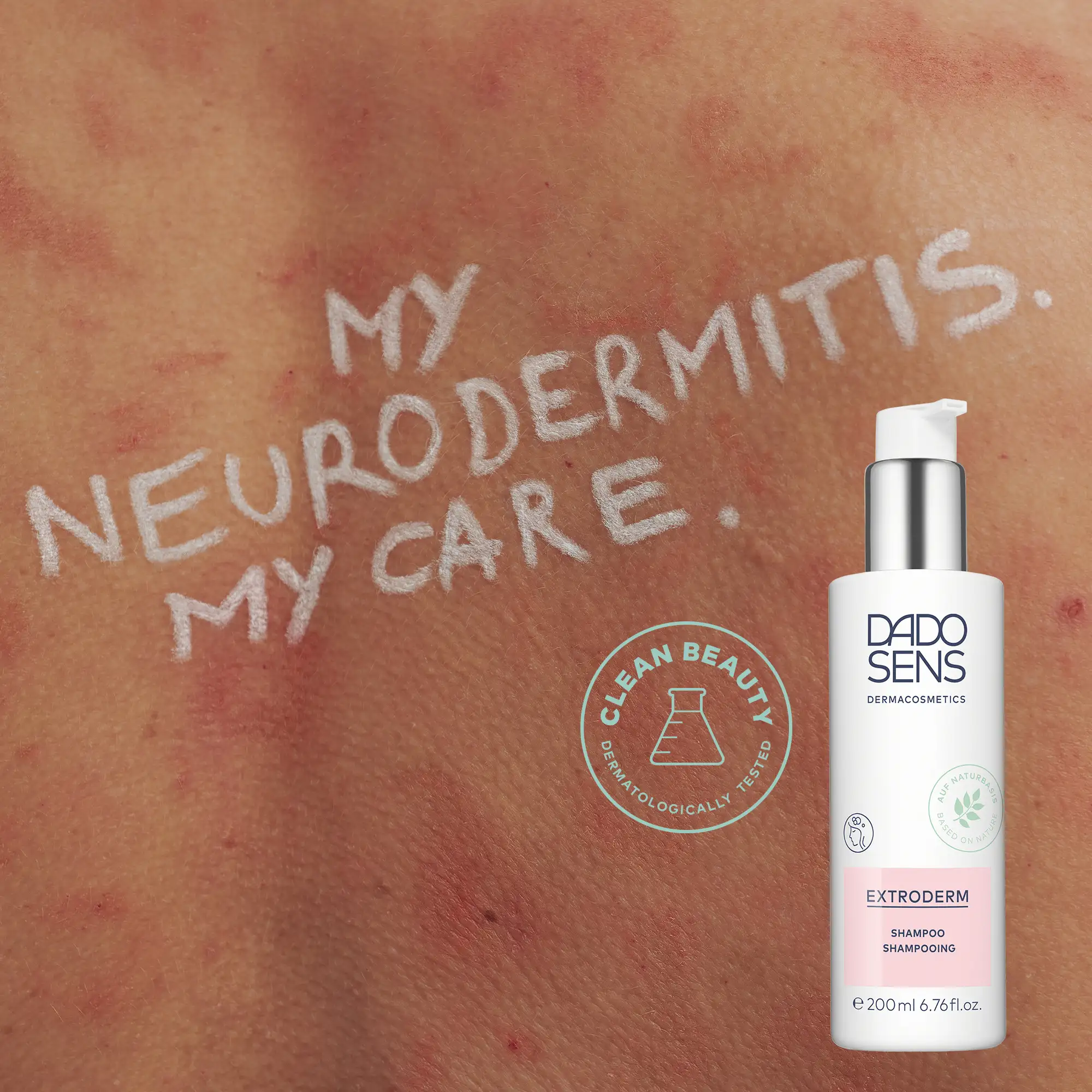 DADO SENS EXTRODERM Shampoo vor geröteter, gereizter Haut mit Aufschrift „My Neurodermitis. My Care.“